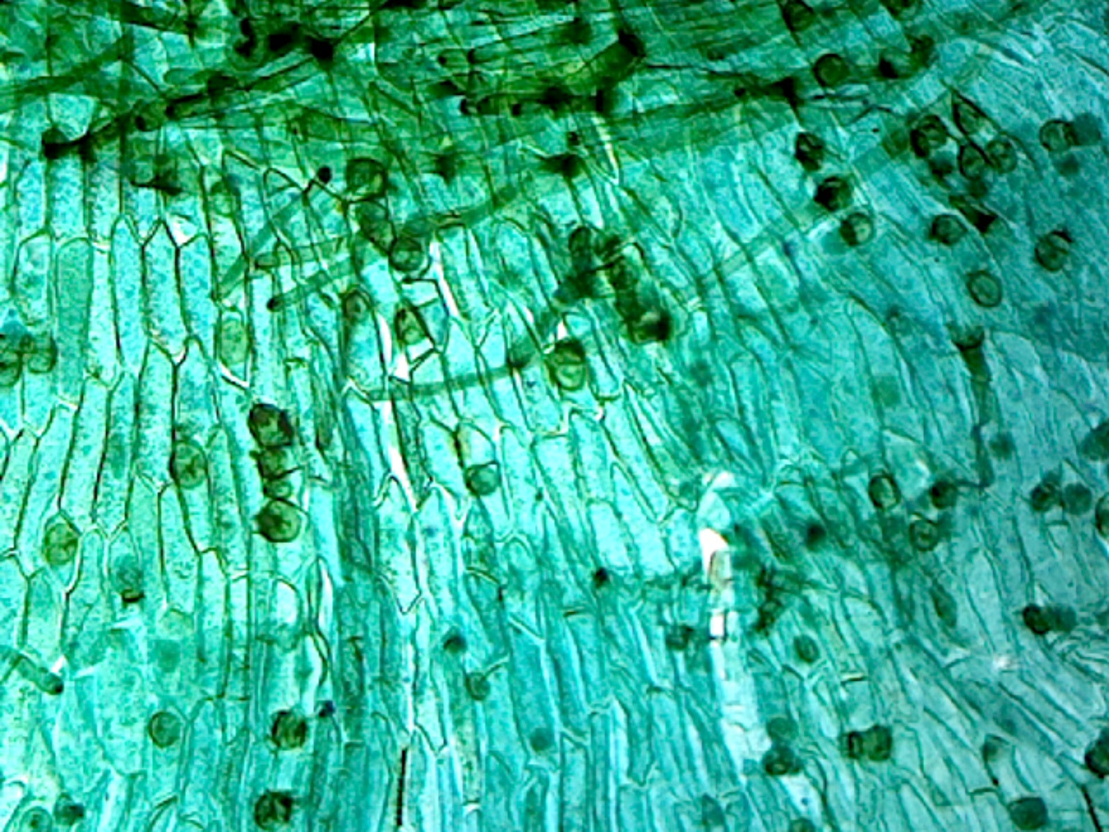 Fern (Pteridophyta) Filamentous Prothallium; Showing Germinating Spores; Whole-mount