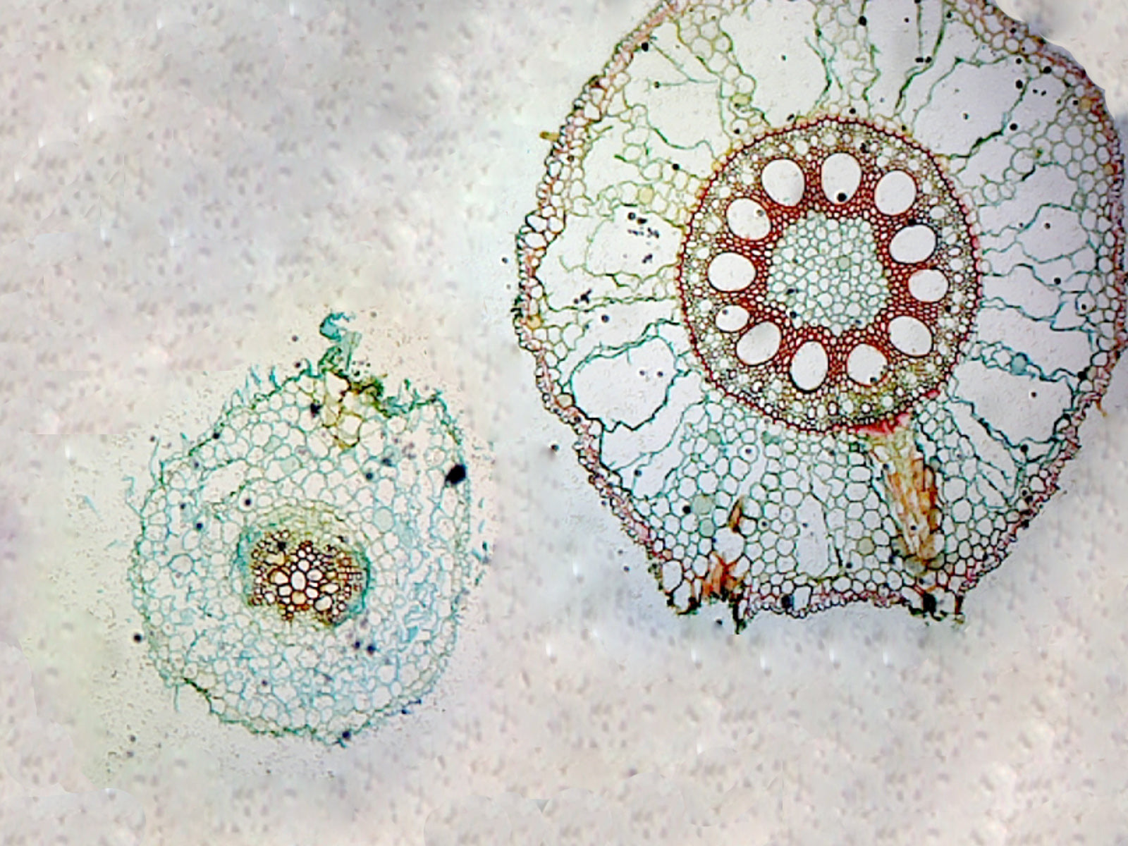 Monocot and Dicot Root Comparison; Cross Section; QS Stain by Go Science Crazy