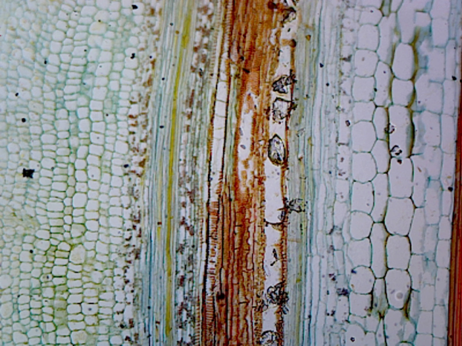 Pumpkin (Cucurbita) Stem; Longitudinal Section