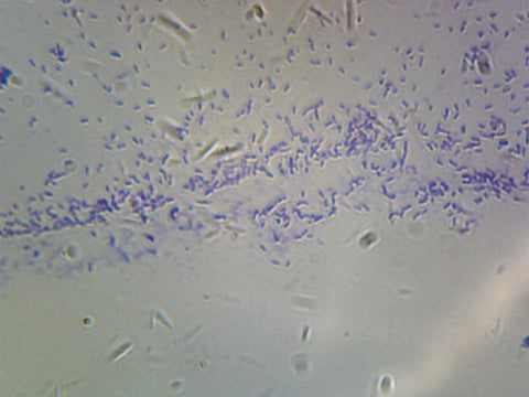 Bacillus; Smear; Mixed Gram-Positive and Gram-Negative by Go Science Crazy