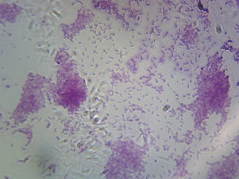 Vibrio Cholerae; Smear by Go Science Crazy