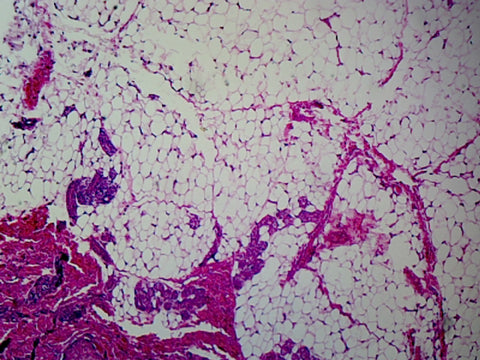 Adipose Tissue, Mammalian; Section; H&E Stain by Go Science Crazy