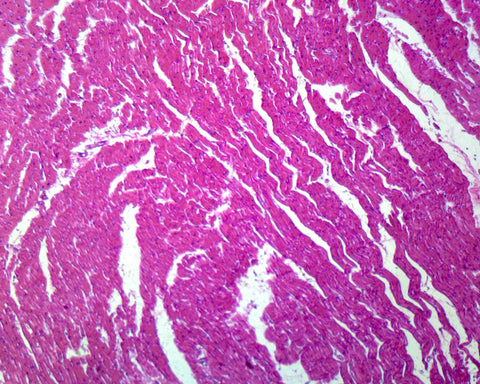 Cardiac Muscle, Human; Cross Section; H&E Stain by Go Science Crazy