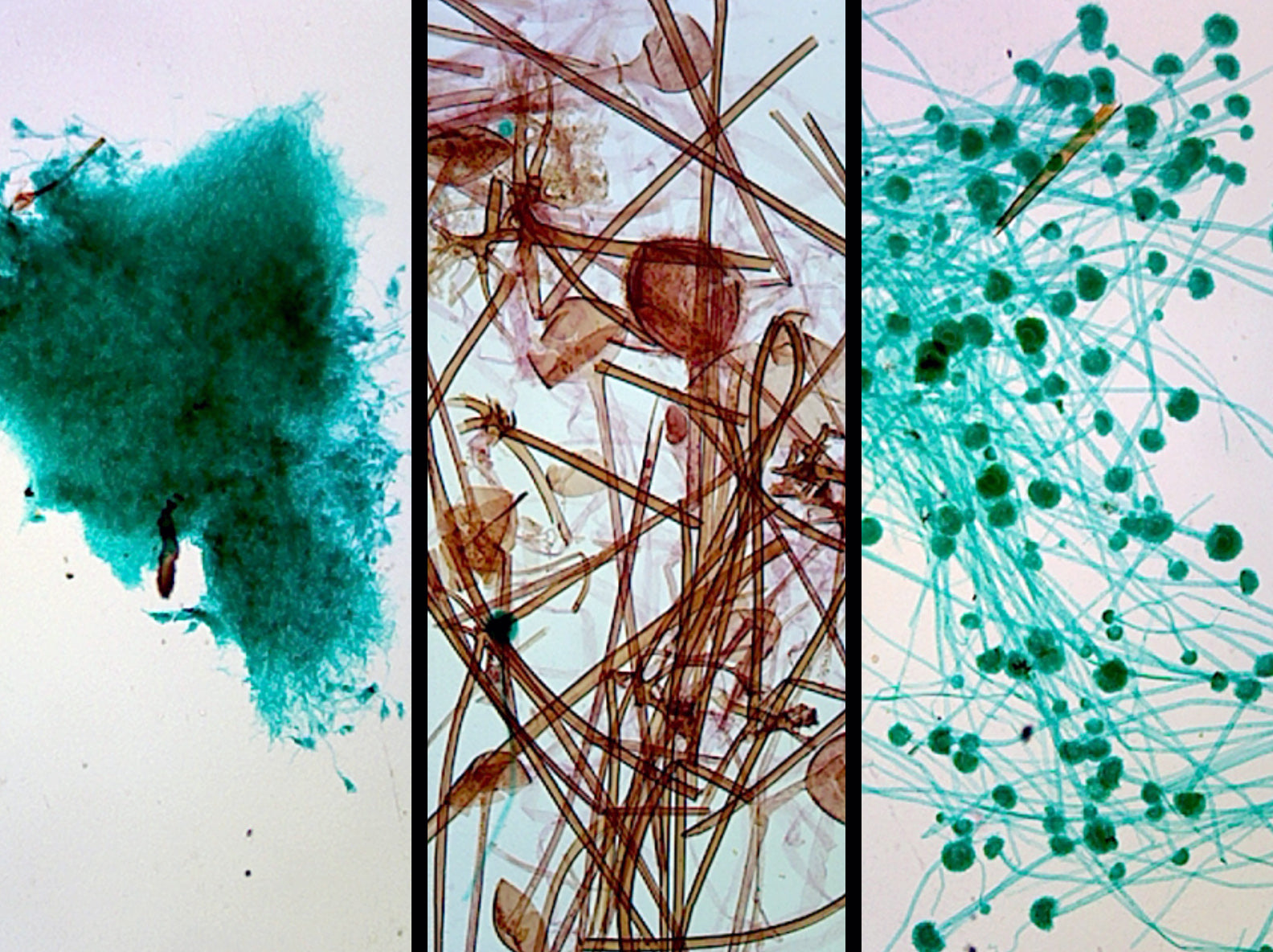 Slide, Prepared Microscope showing Three Types of Mold, Aspergillus, Penicillium, and Rhizopus, Whole-mount