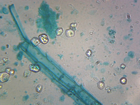 Anabaena; Blue-green Algae; Filamentous Cyanobacteria; Shows Heterocysts and Spores; Whole-mount by Go Science Crazy