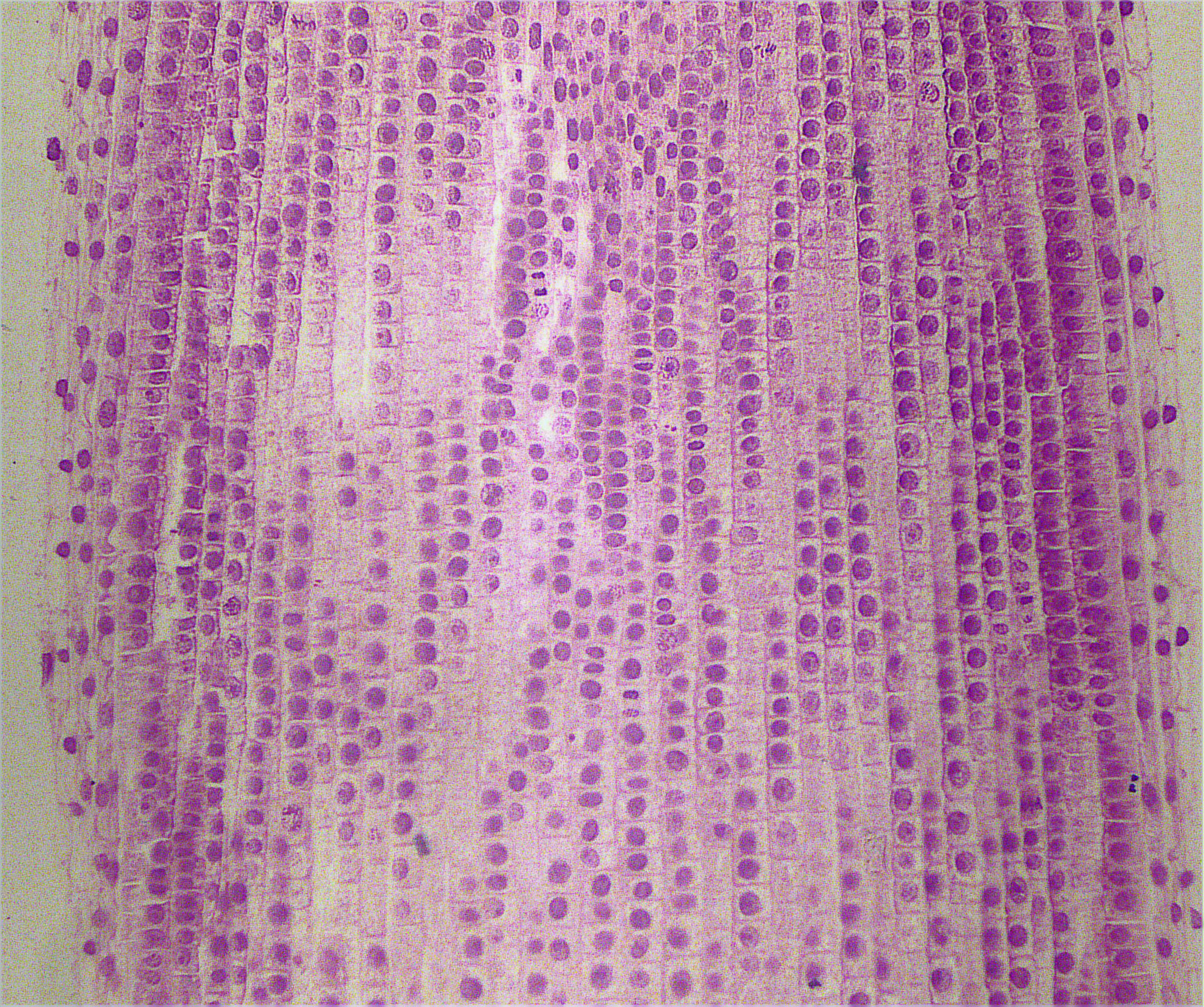 Onion Mitosis; Showing All Stages; Lateral Section