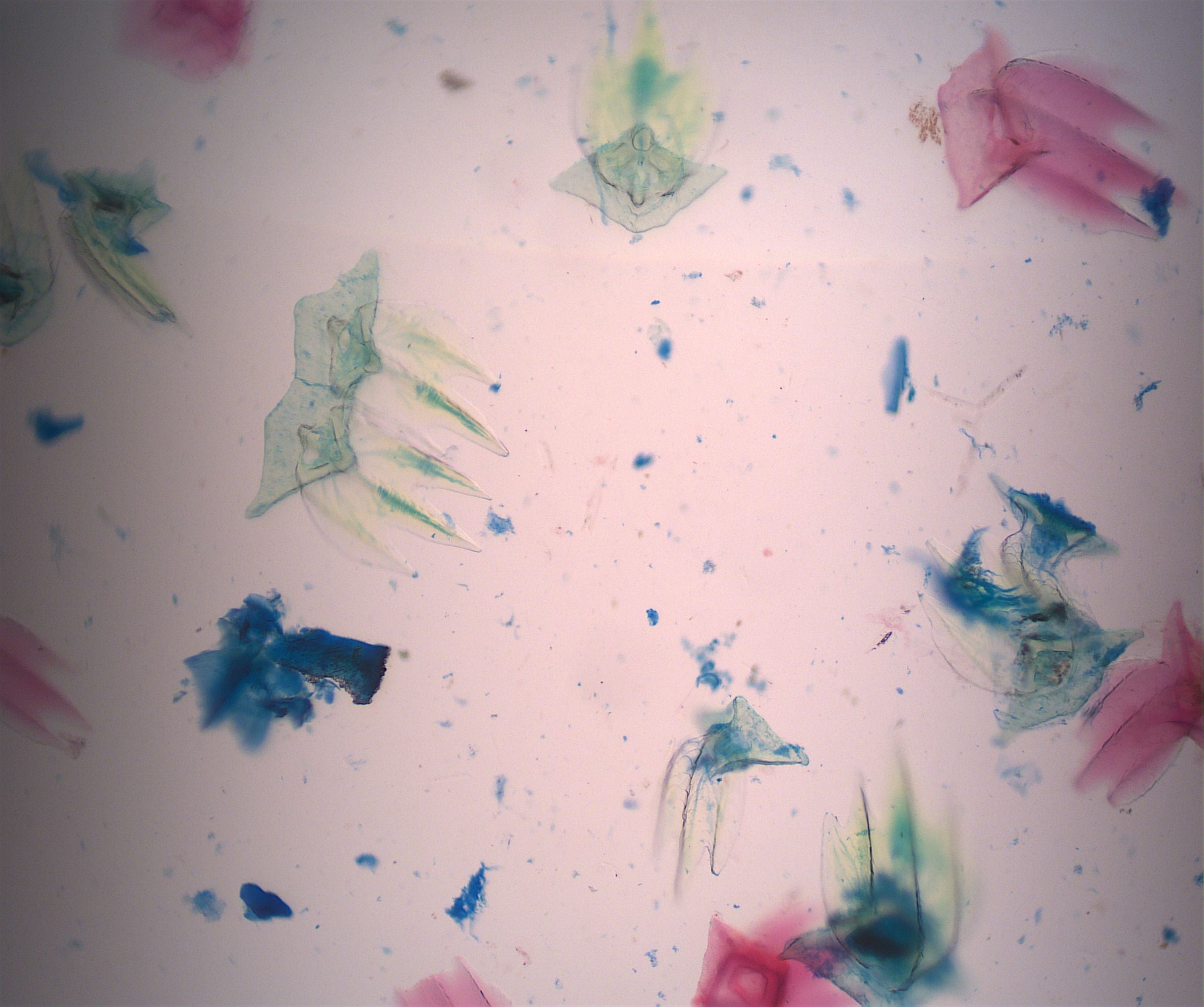 Prepared Slide, Dogfish Placoid Scale