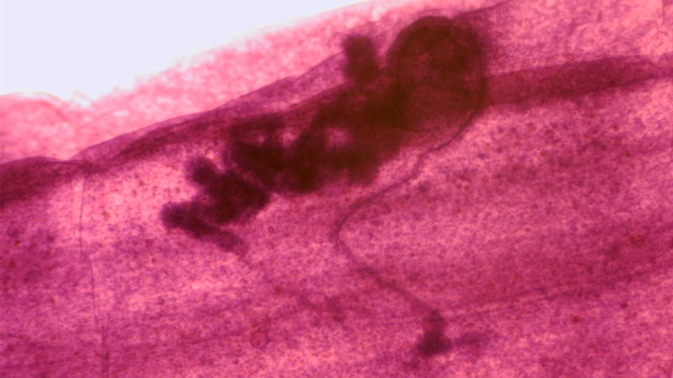 Taenia Immature Proglottid, from cow or sheep. by Go Science Crazy