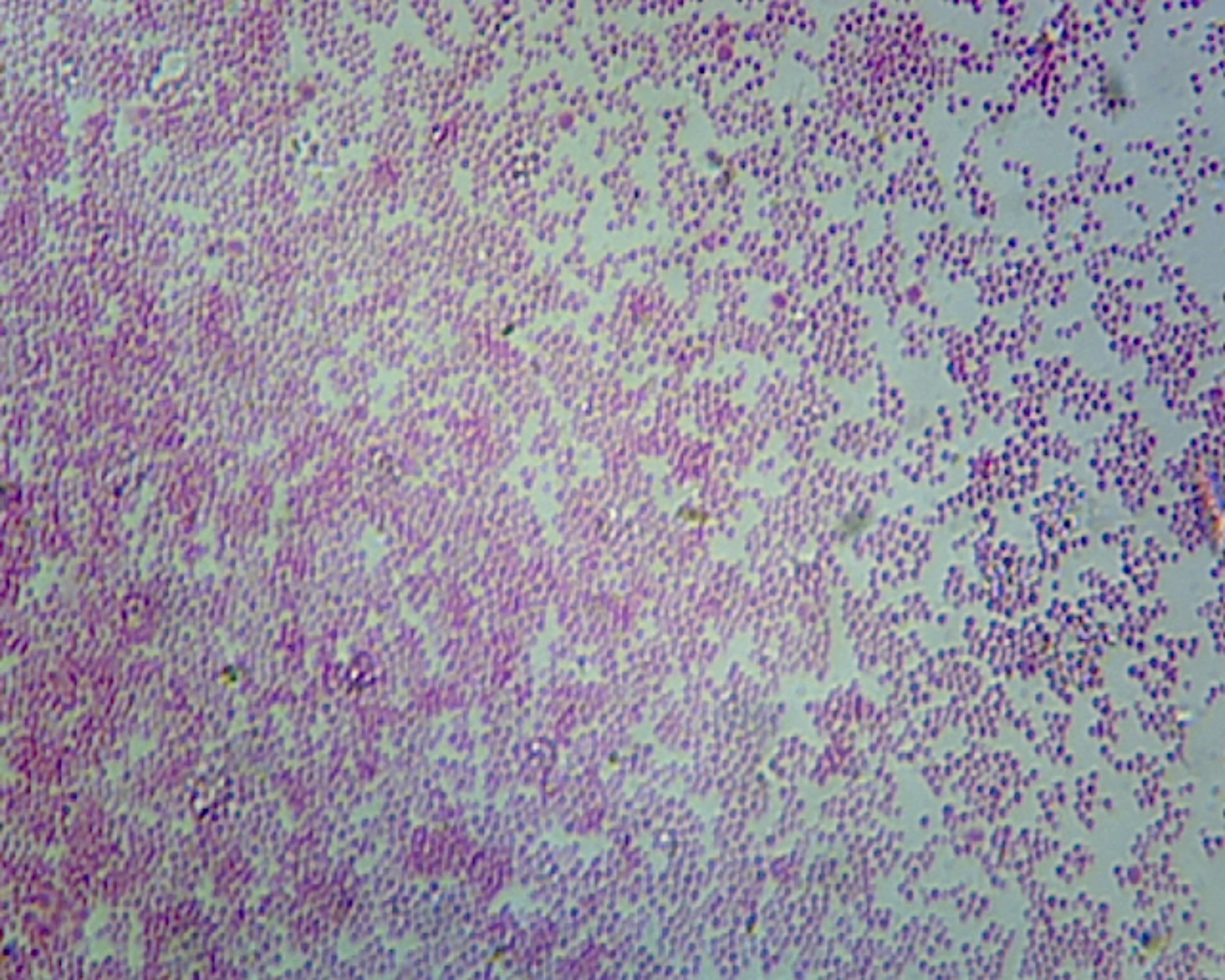 Escherichia Coli; Smear; Gram-Negative by Go Science Crazy