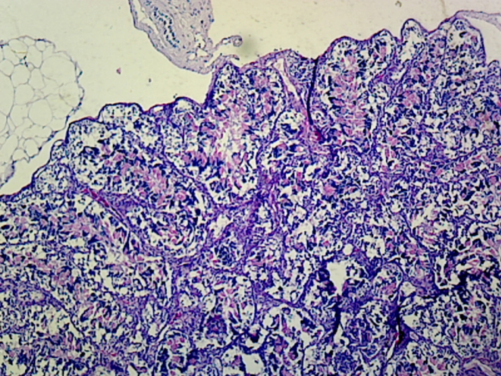 Frog Testis; Section; IH Stain by Go Science Crazy