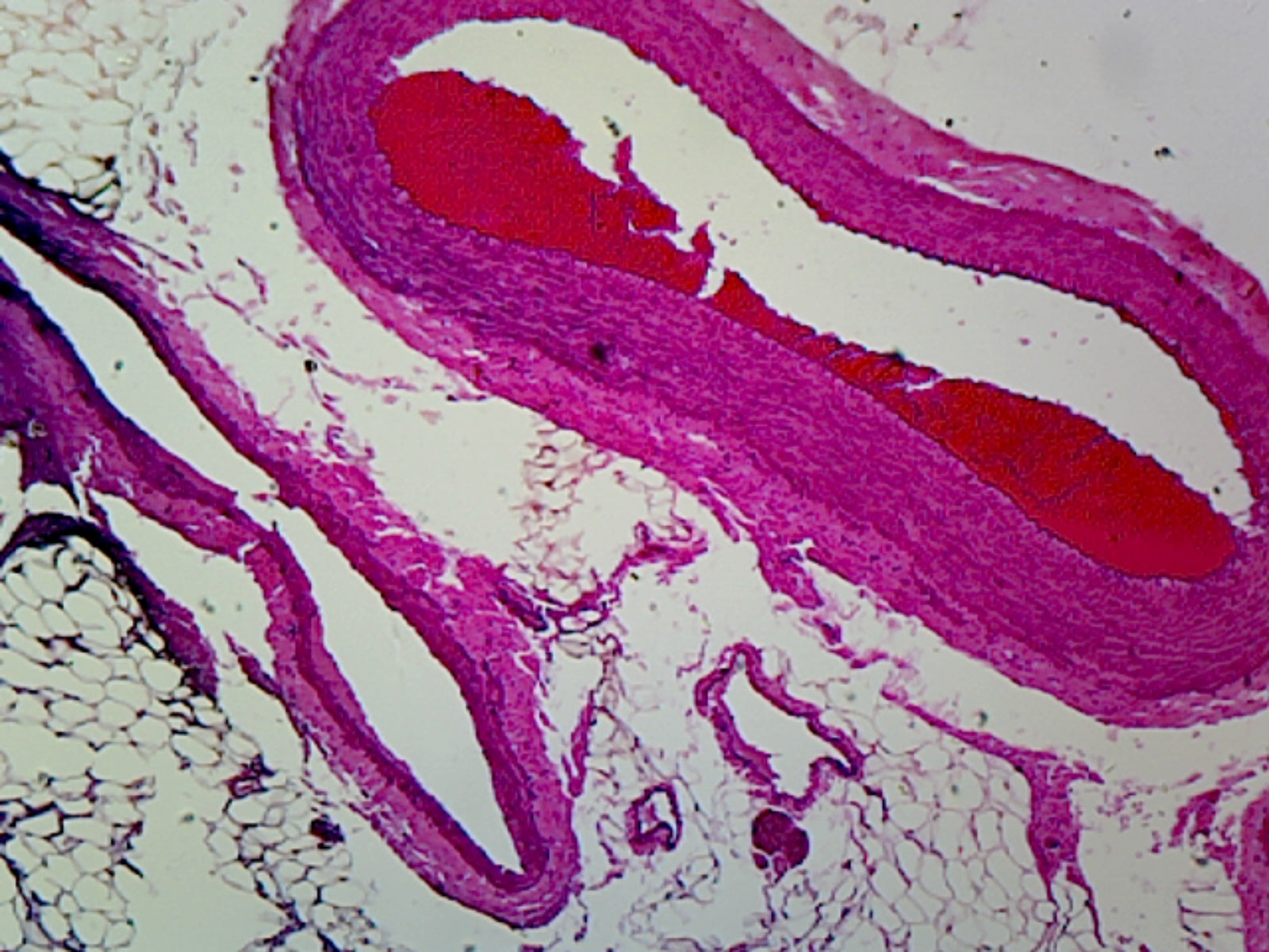 Human Artery, Vein, and Nerve; Cross Section by Go Science Crazy