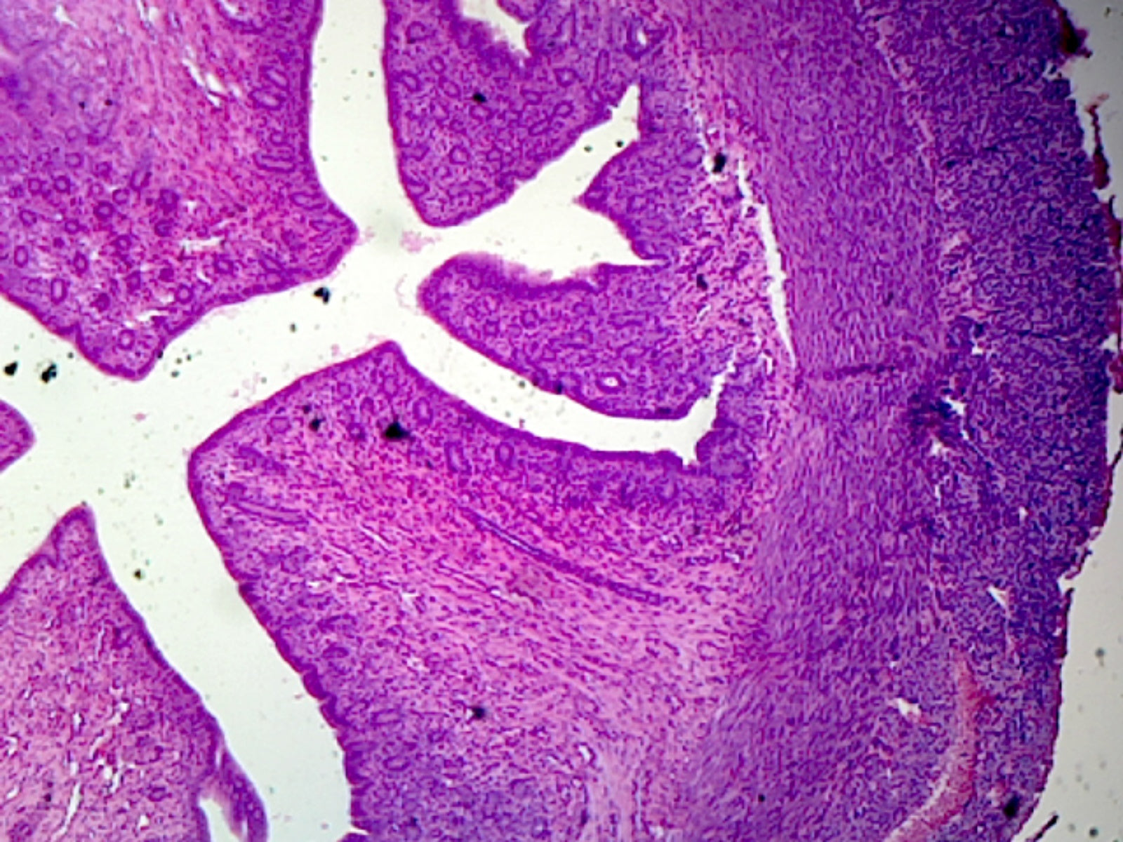 Uterus, Mammalian; Showing General Structures; Section by Go Science Crazy