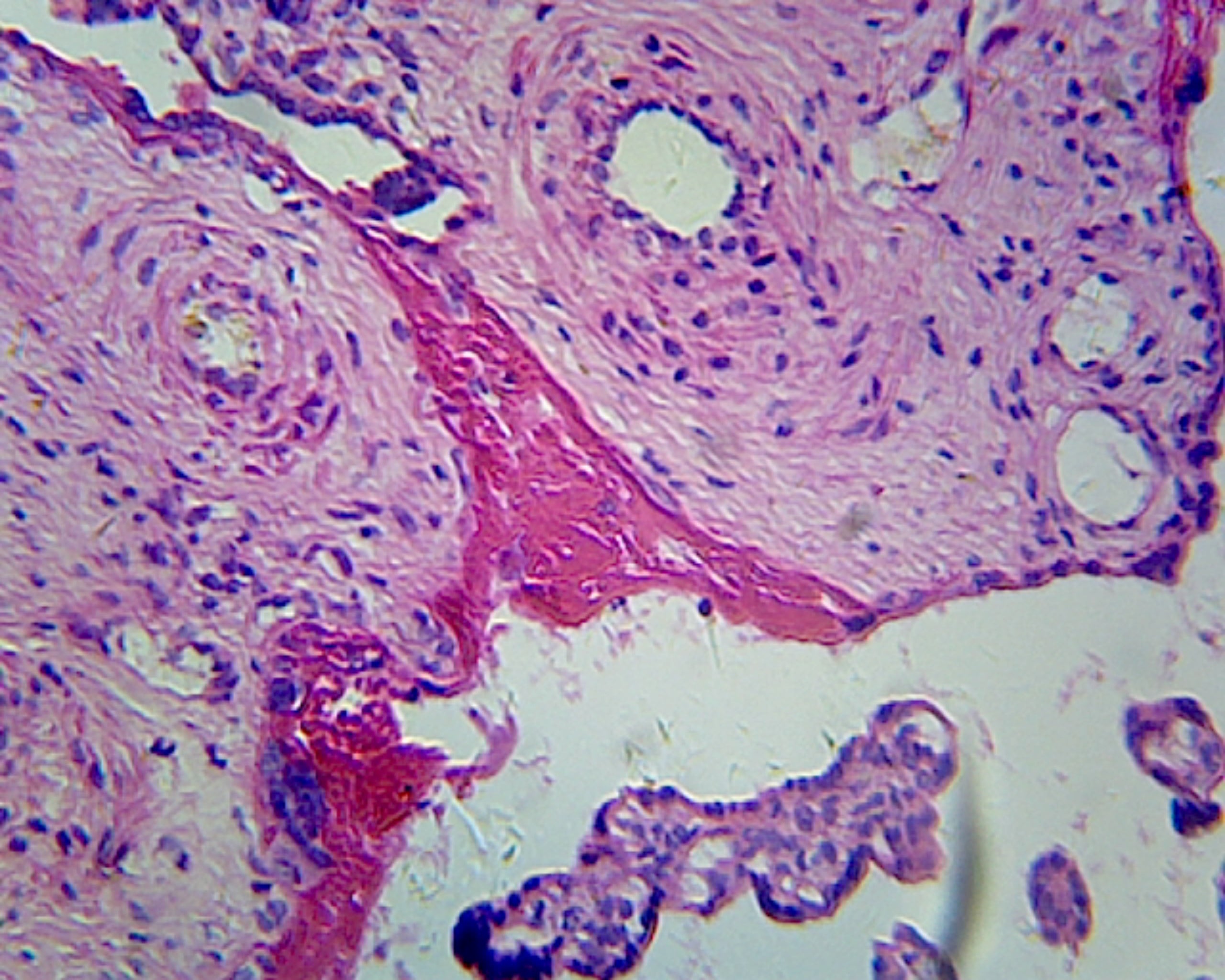 Placenta, Human; Showing Chorionic Villi; Section by Go Science Crazy