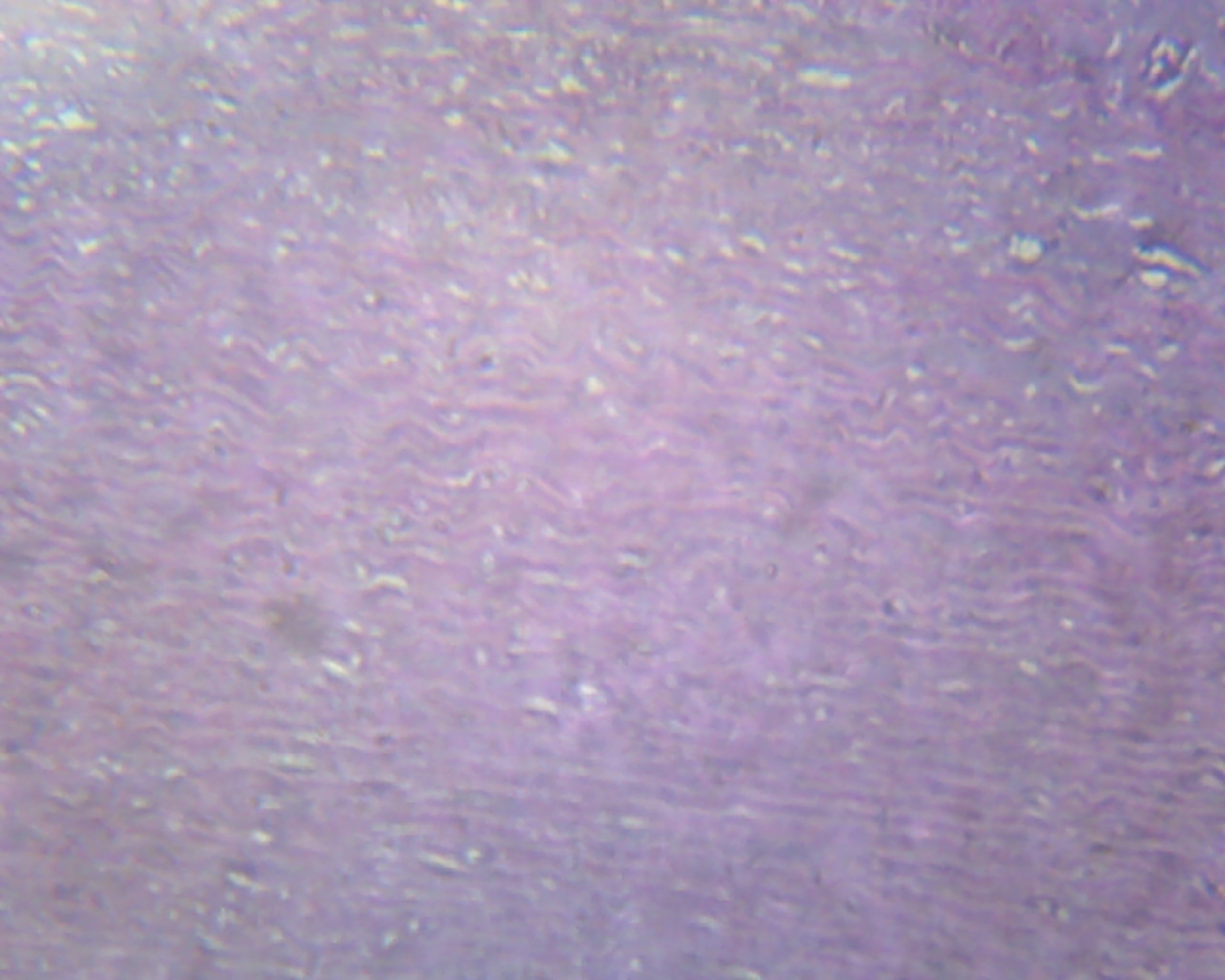 Atherosclerosis (Human); Section; H&E Stain; Showing Section of Coronary Artery by Go Science Crazy