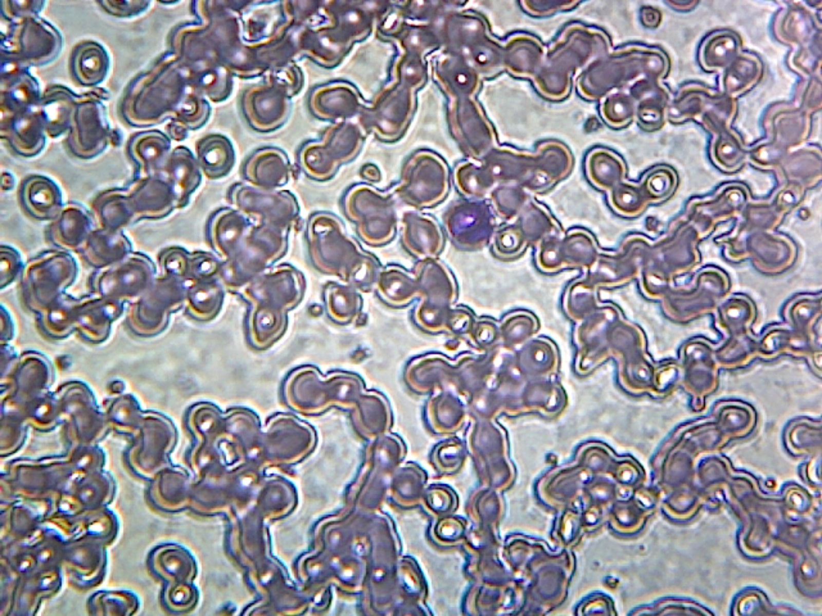 Iron-Deficient Anemia Blood (Human); Smear; GS Stain; Showing Peripheral Blood Film with Small, Pale Red Blood Cells by Go Science Crazy