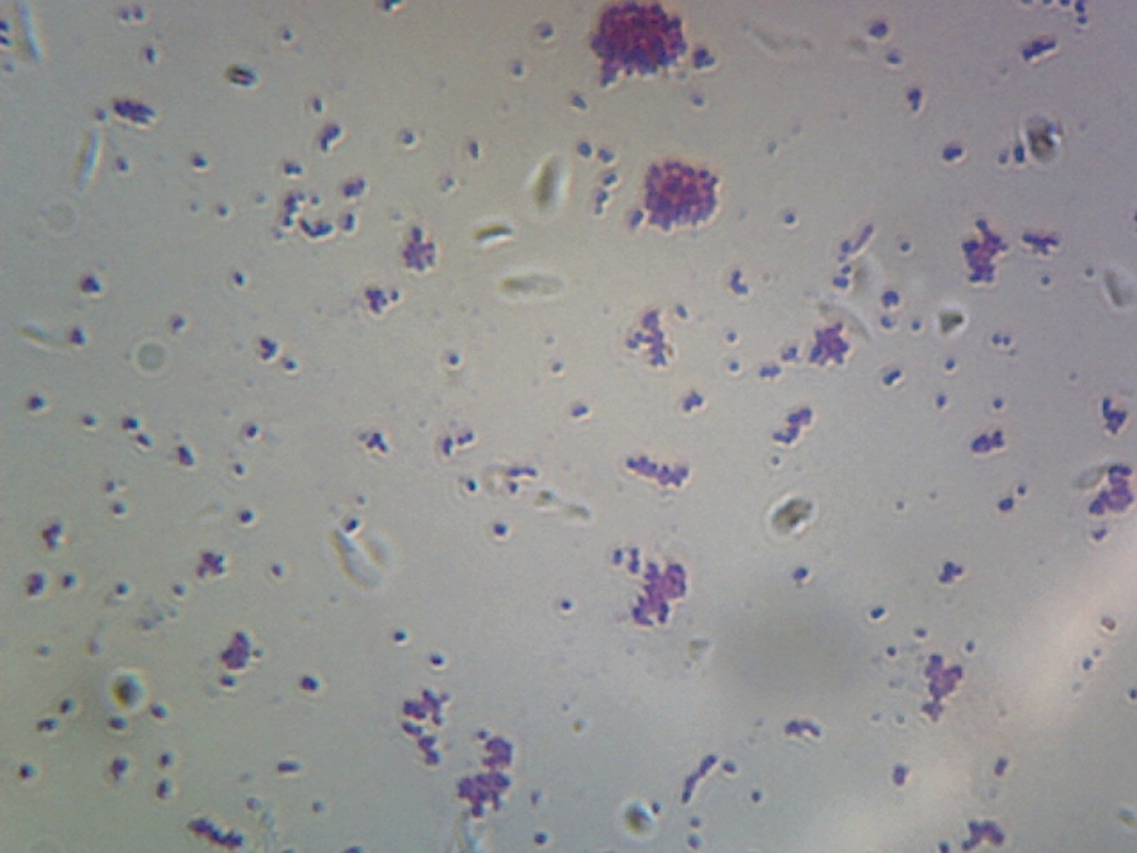 Coccus; Smear; Gram-Negative by Go Science Crazy
