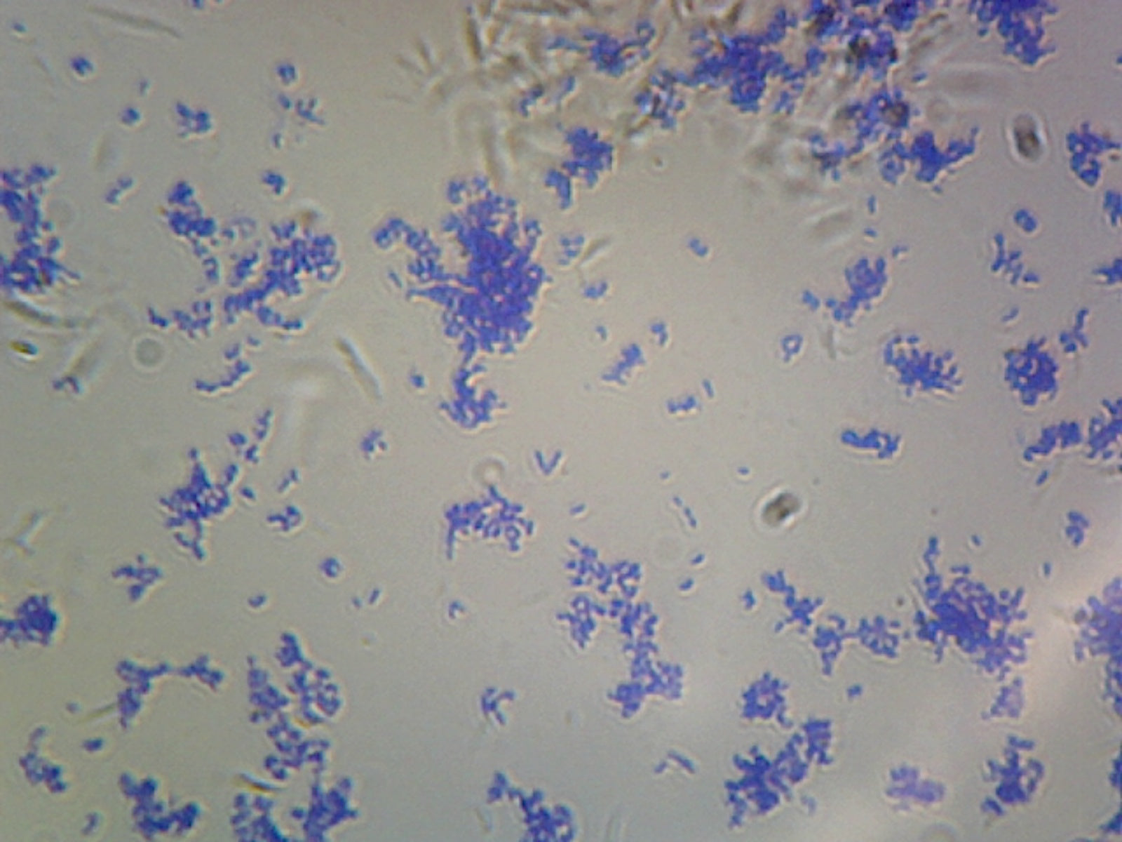 Corynebacterium Diphtheriae, Rod-Shaped; Smear; Gram-Positive by Go Science Crazy