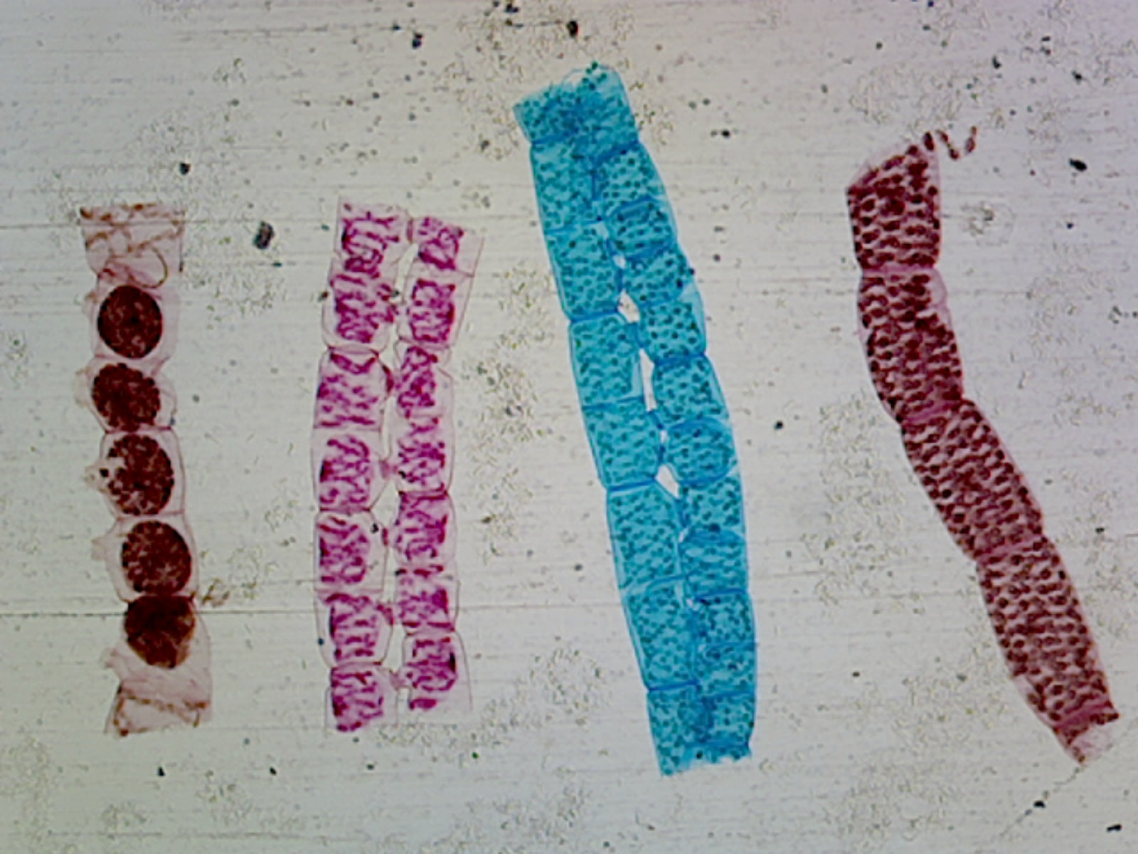 Spirogyra, Scalariform Conjugation; All Stages; Whole-mount by Go Science Crazy