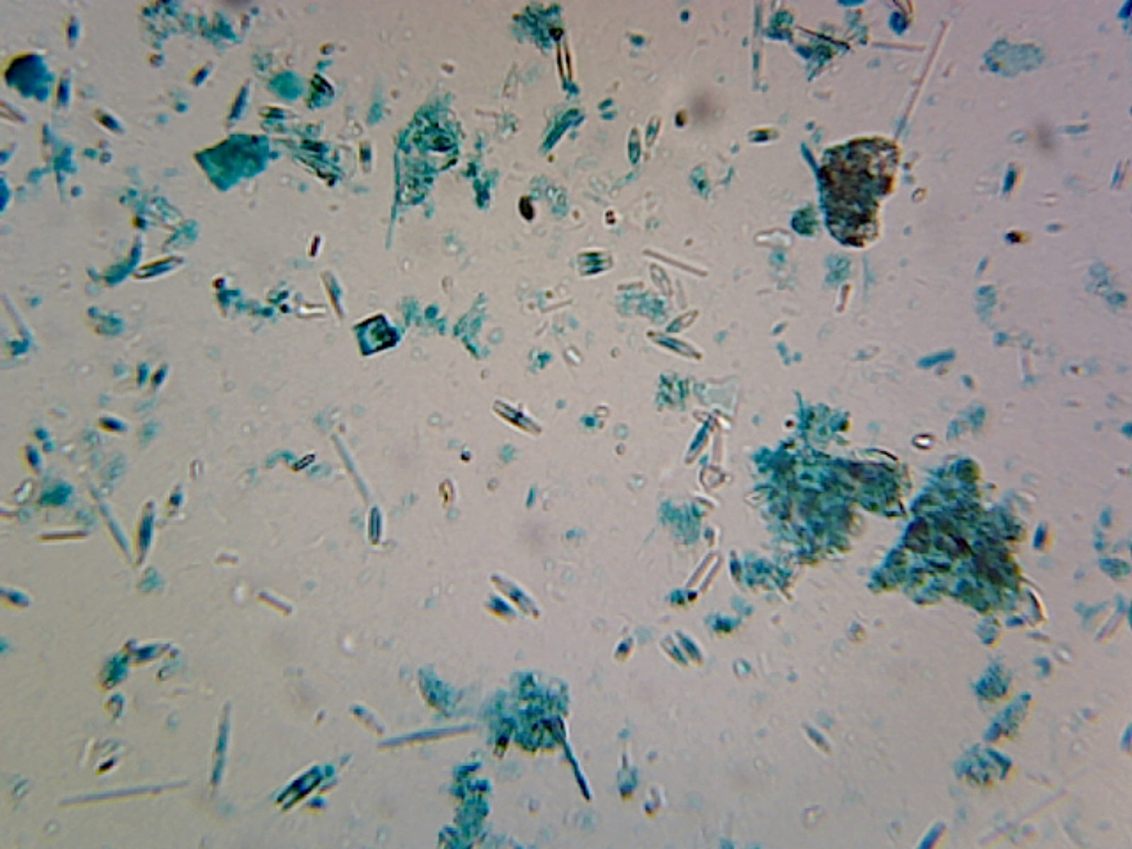 Diatomeae (Comparing Various Mixed Diatoms); Whole-mount by Go Science Crazy