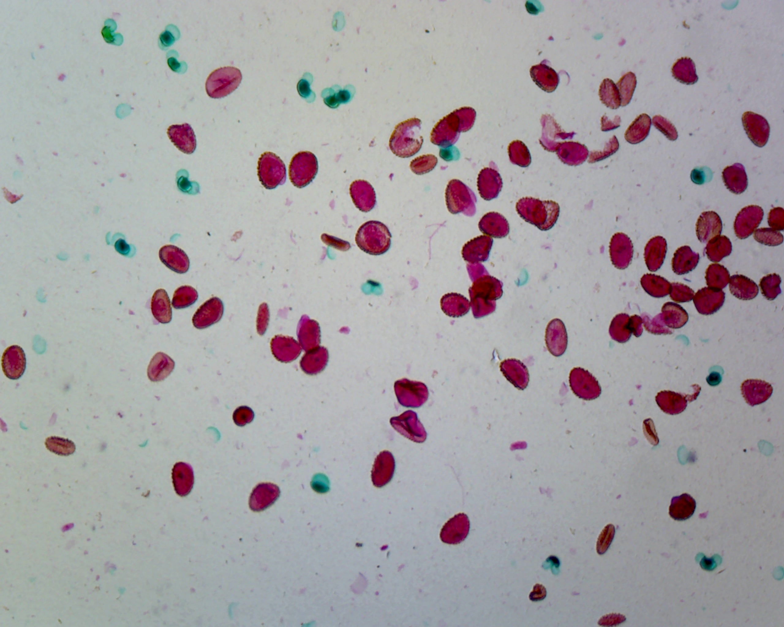 Mixed Pollen Comparison; Typical Dicot Pollens; Whole-mount by Go Science Crazy