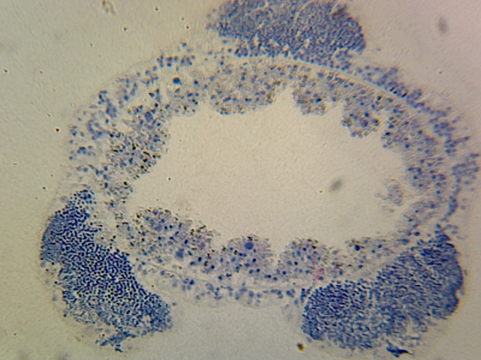 Hydra with Male Gonad (Spermary); Whole-mount by Go Science Crazy