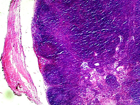 Lymph Node, Mammalian; Section by Go Science Crazy