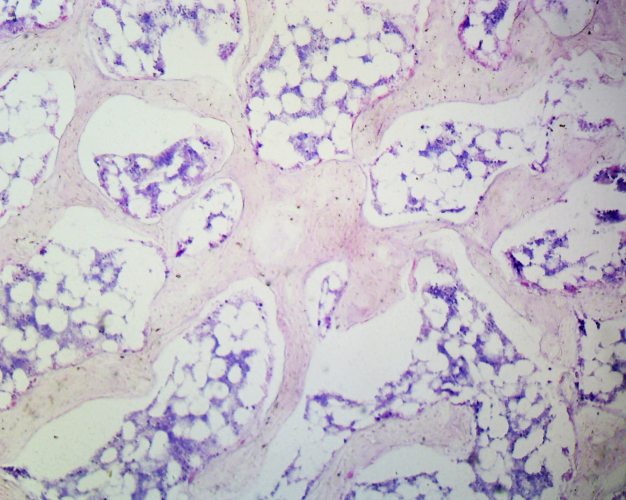 Spongy Bone, Mammalian; Section by Go Science Crazy