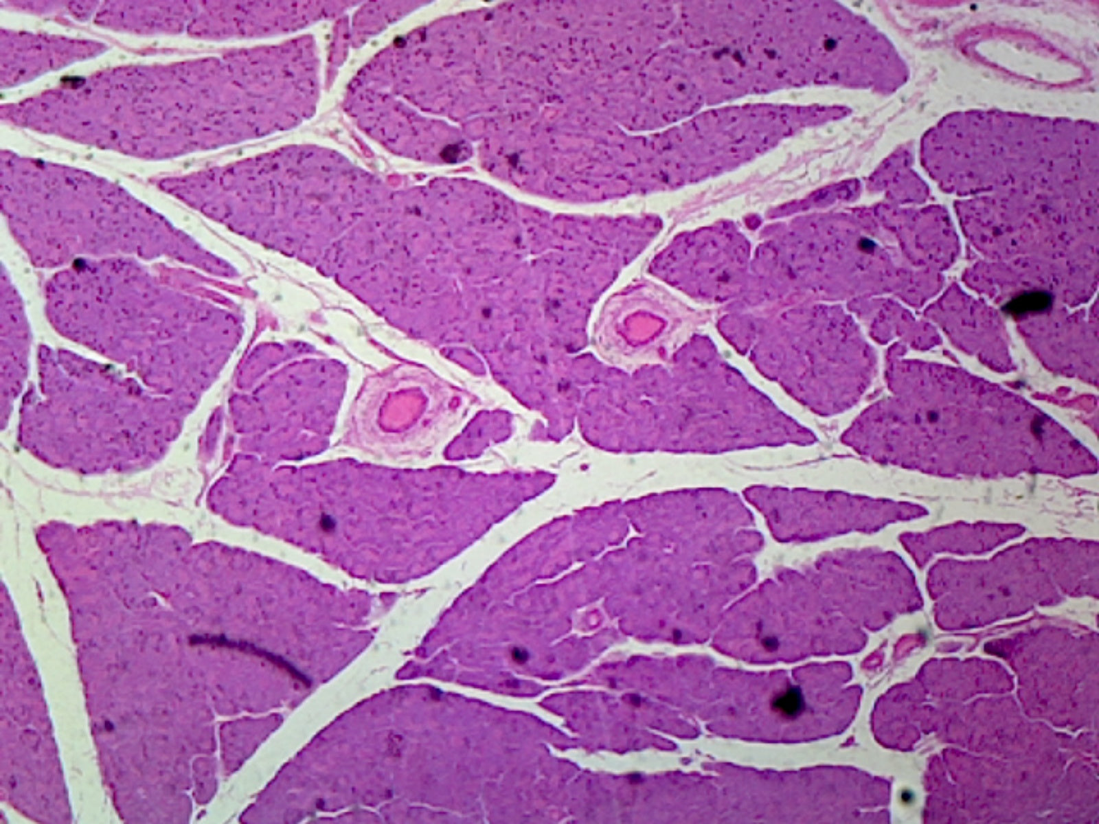 Pancreas, Mammalian; Section; Showing Acini, Ducts, and Islets of Langerhans by Go Science Crazy