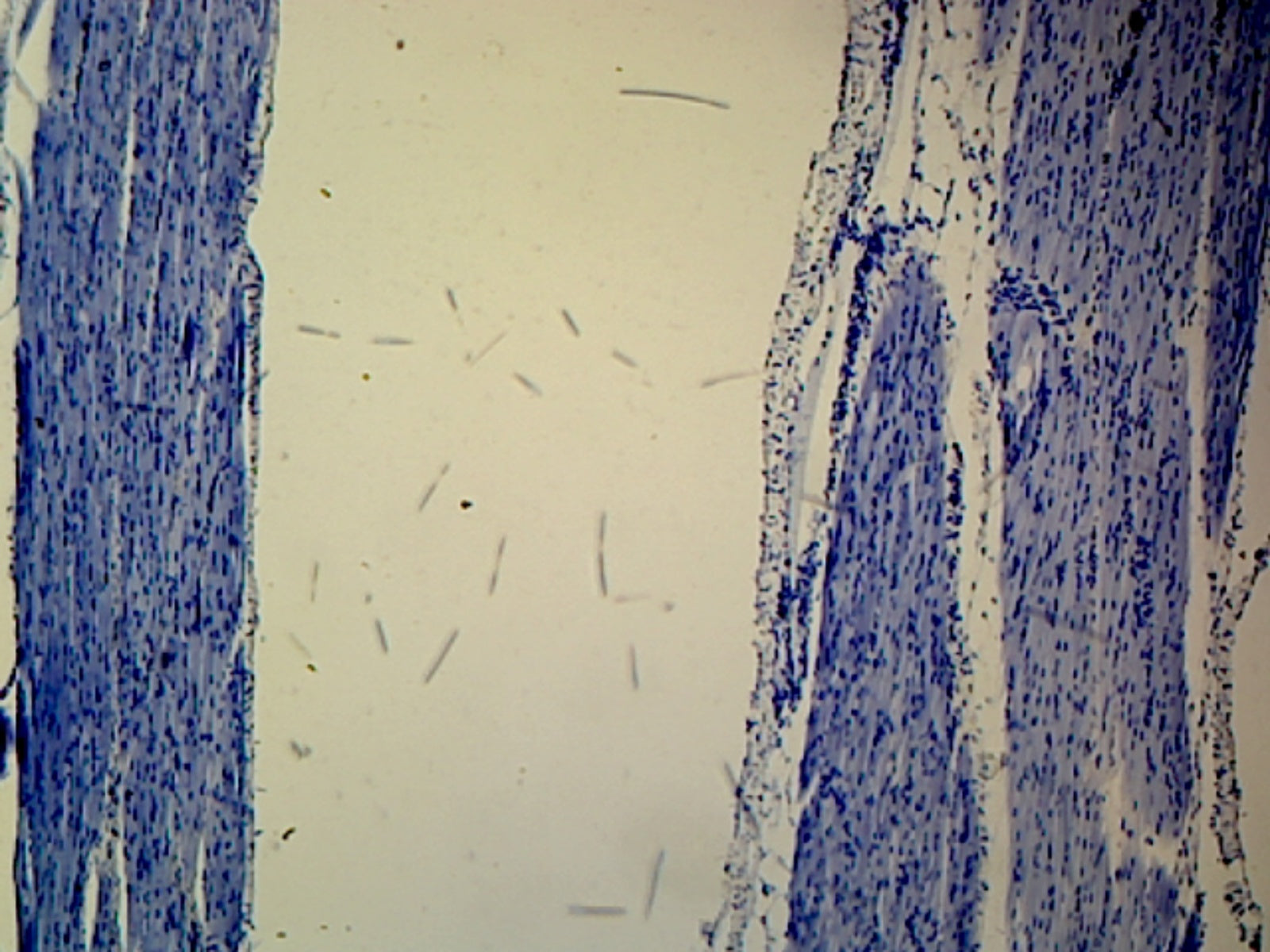 Skeletal Muscle, Mammalian; Longitudinal Section by Go Science Crazy
