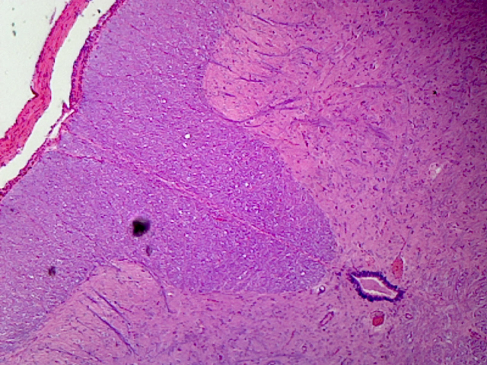 Spinal Cord; Cross Section by Go Science Crazy