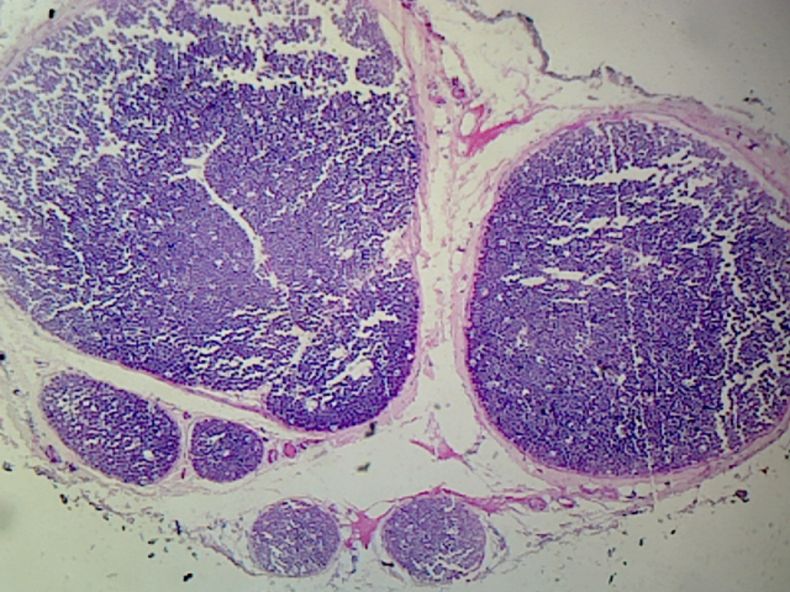Myelinated Peripheral Nerve, Human; Cross Section by Go Science Crazy