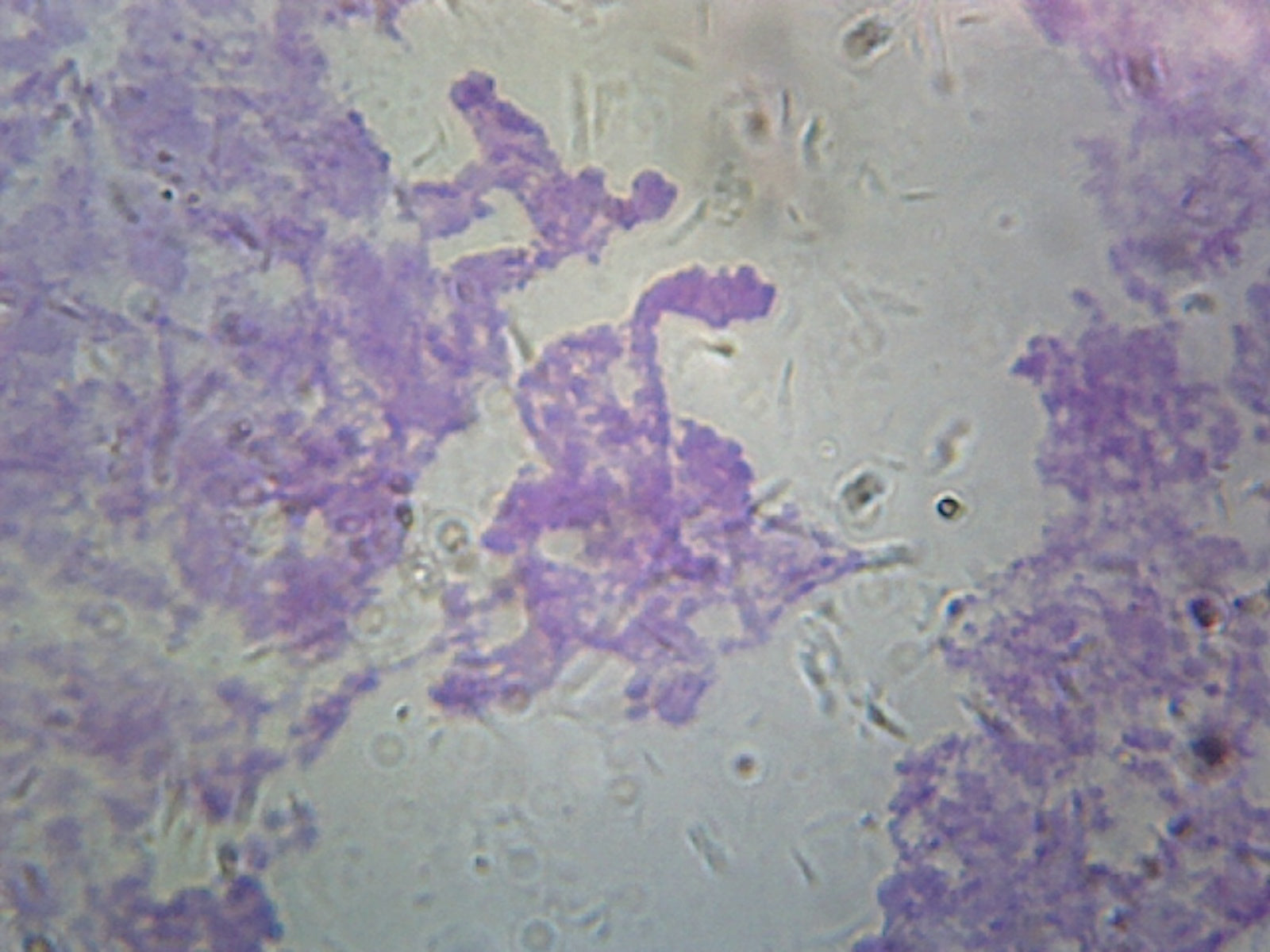 Chromosomes, Drosophila Melanogaster; Smear from Salivary Glands by Go Science Crazy