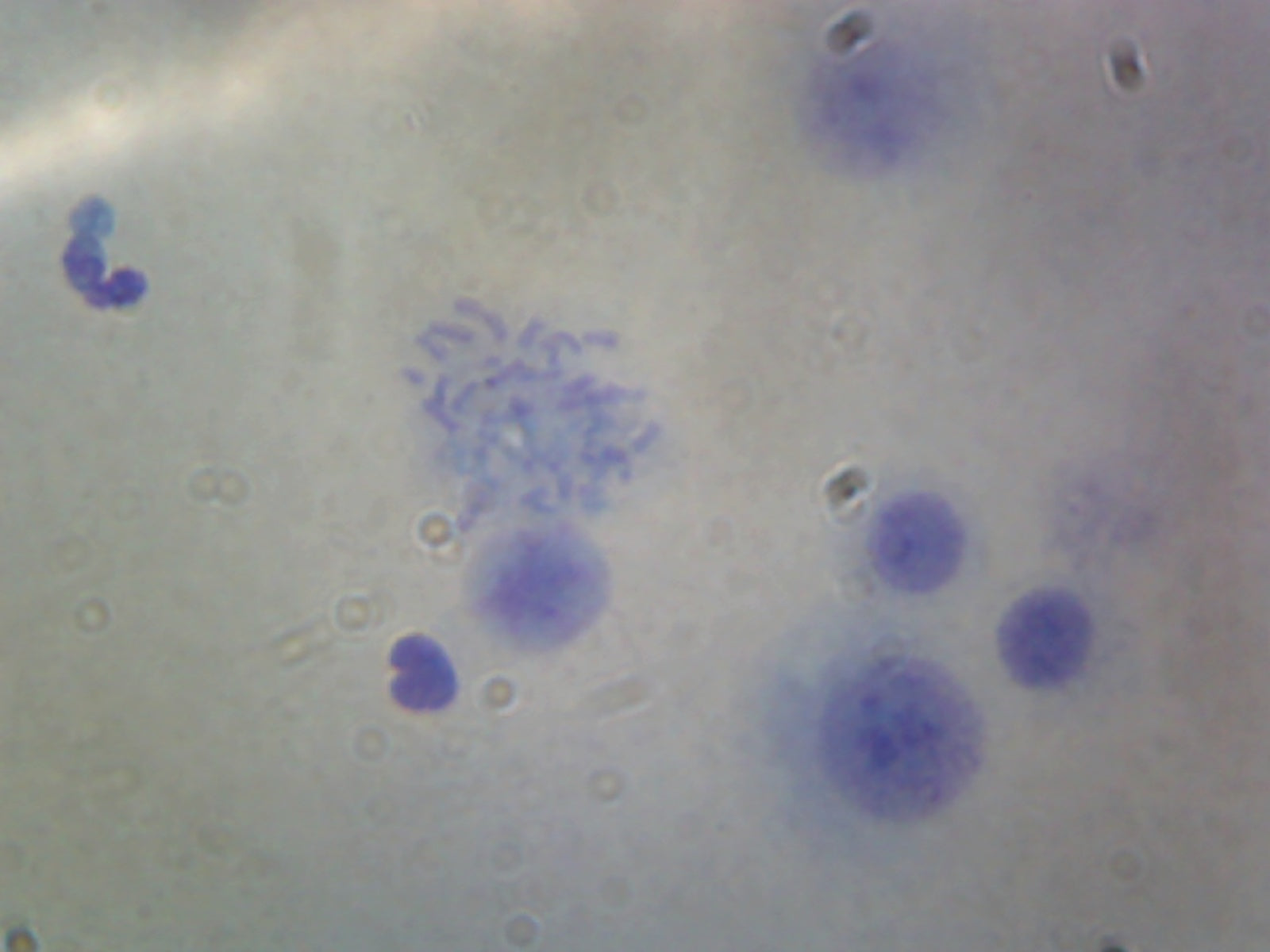 Female Chromosomes, Human; Smear by Go Science Crazy