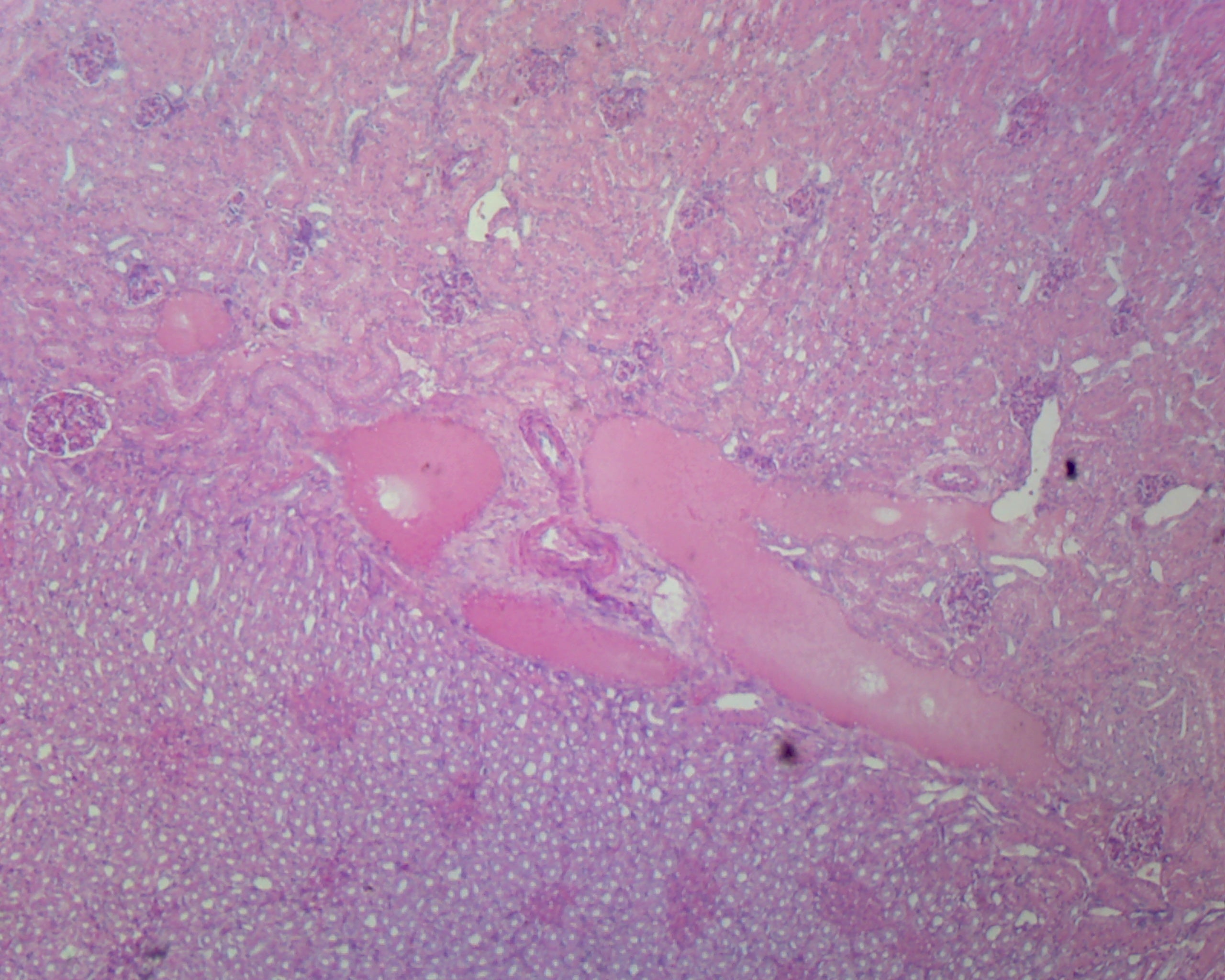 Kidney, Human; Section by Go Science Crazy