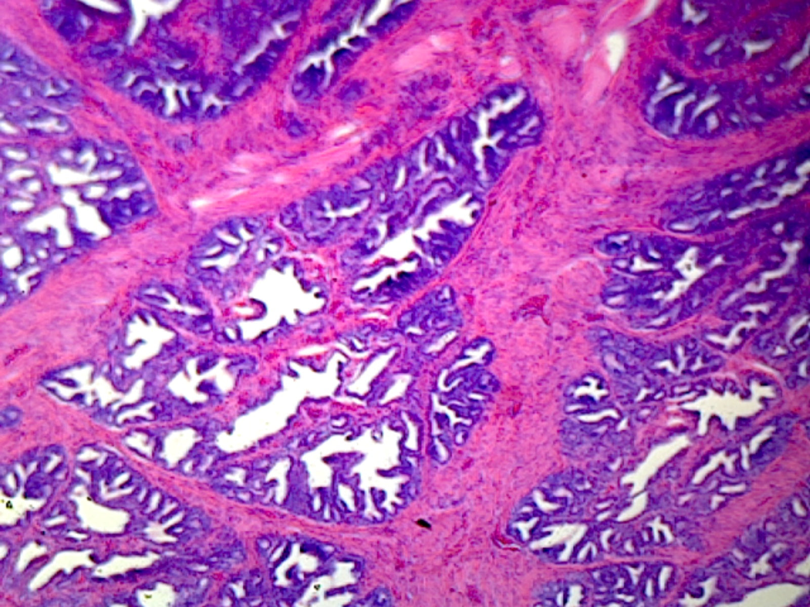Prostate, Human; Showing Glandular Epithelium; Section; H&E Stain by Go Science Crazy