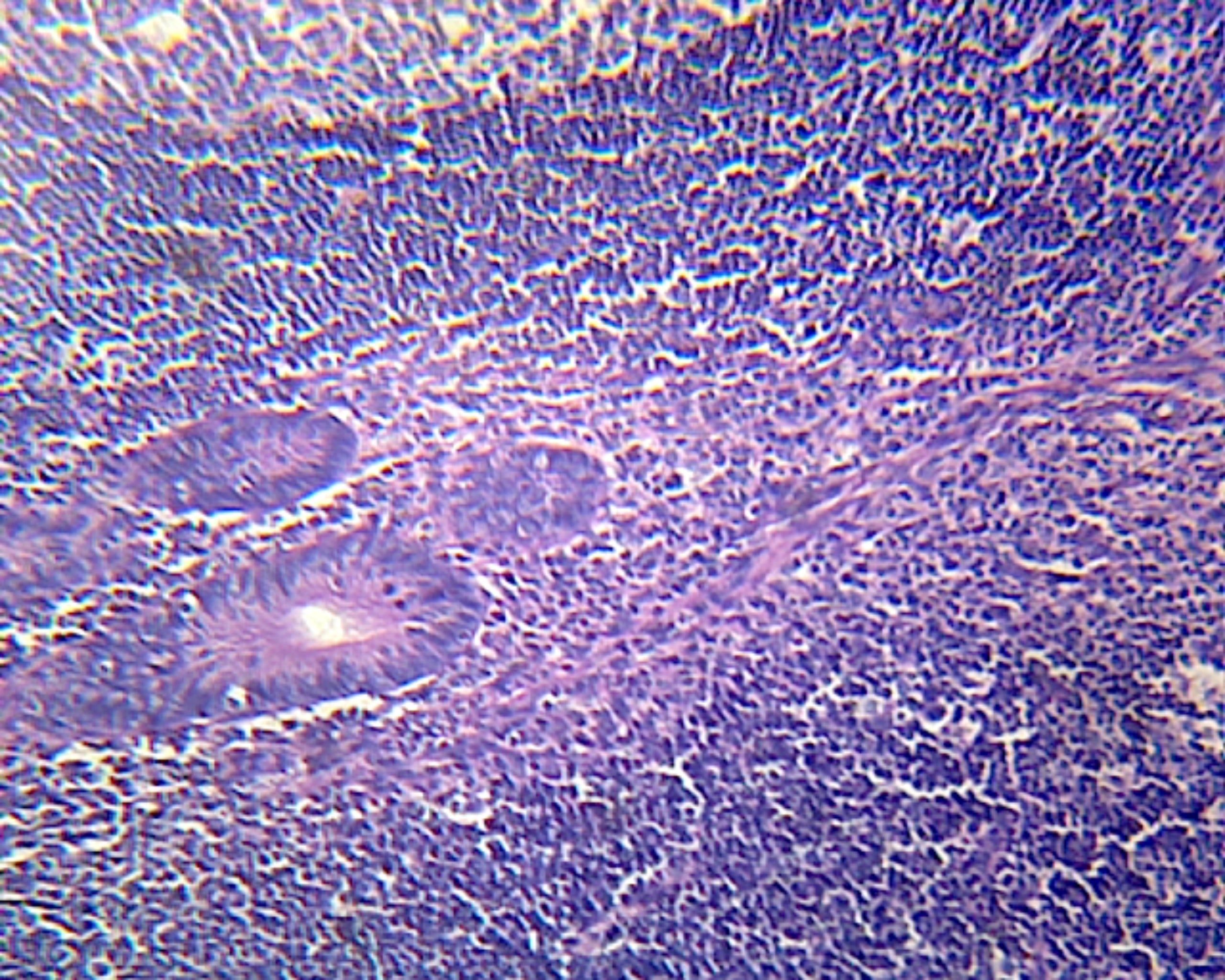 Vermiform Appendix; Section by Go Science Crazy