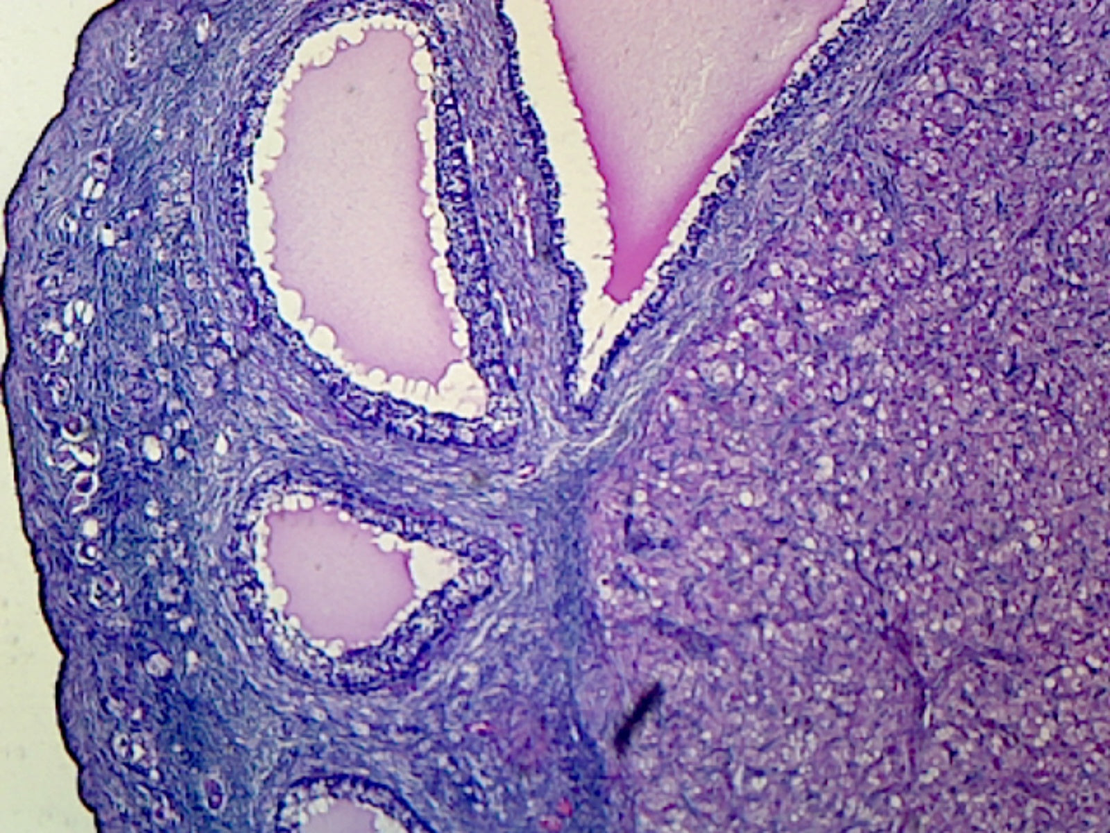 Corpus Luteum, Mammalian; Section by Go Science Crazy
