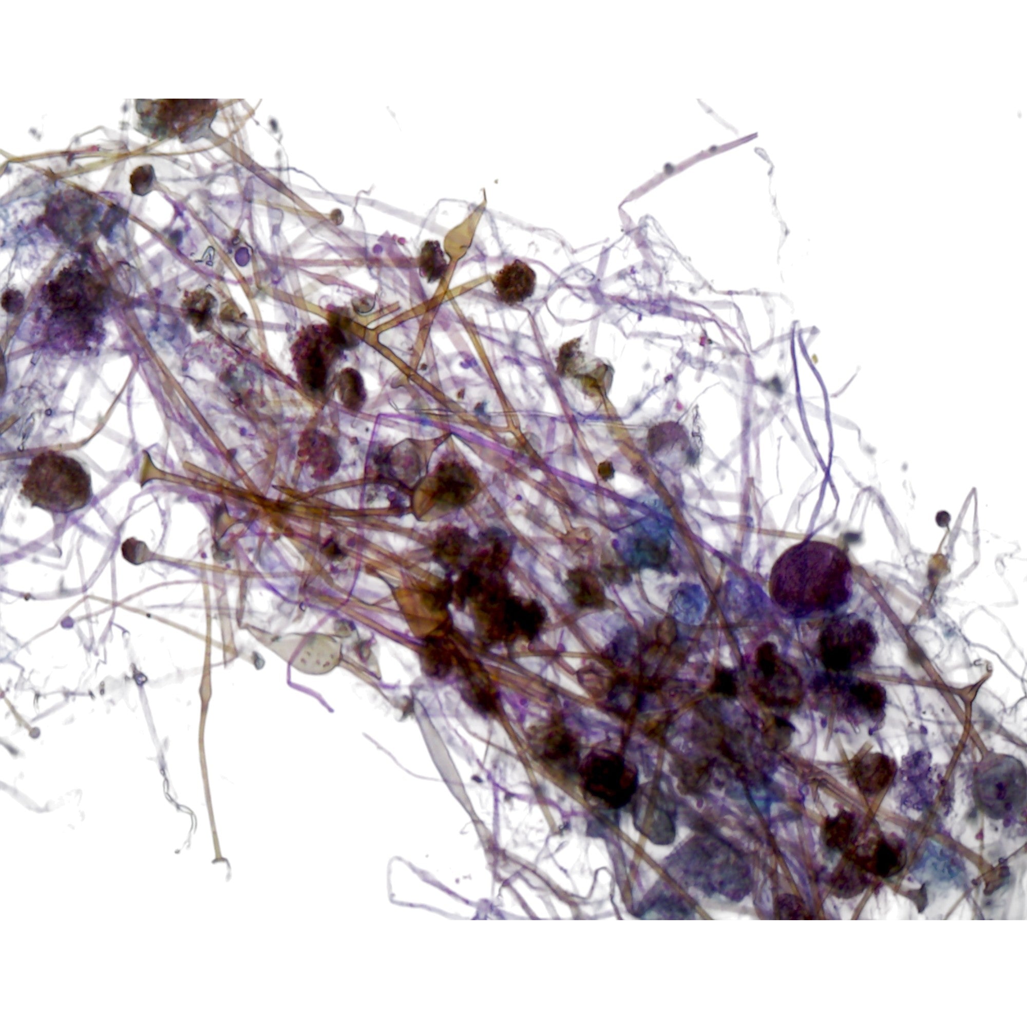 Microscope Slide, Rhizopus Sporangia; Whole-mount