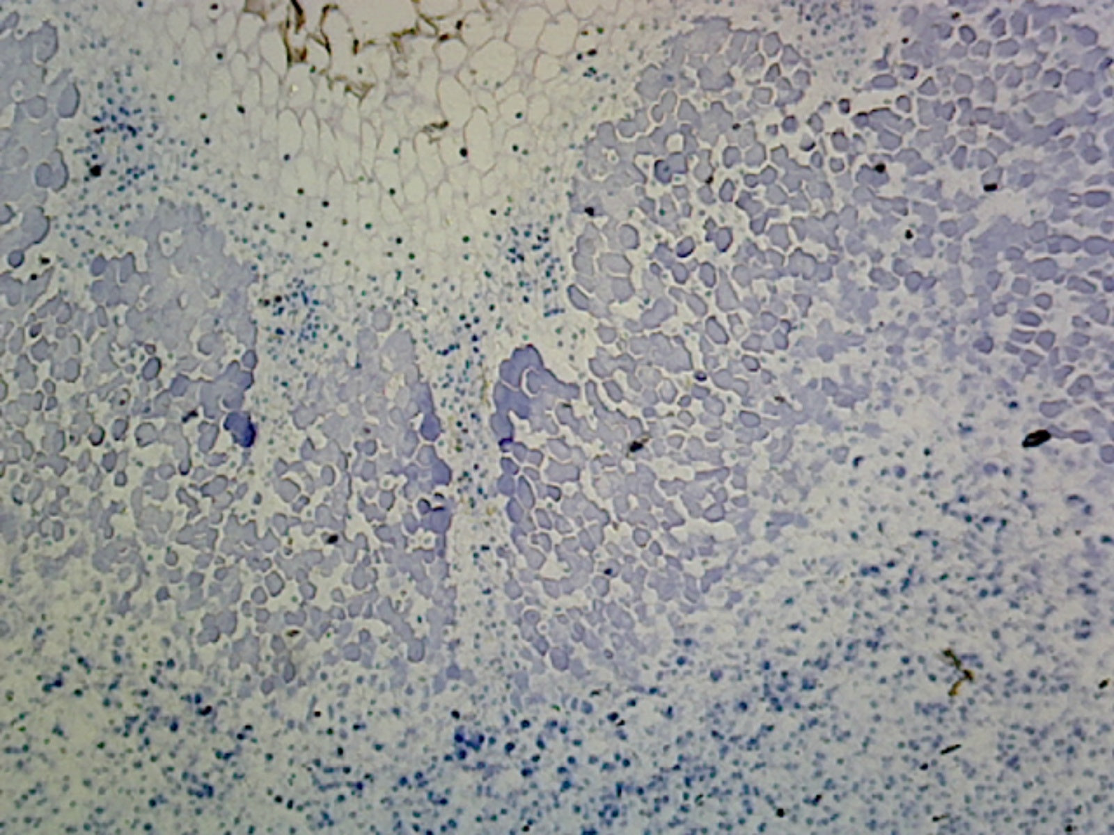 Legume Root Nodule; Section Showing Nitrogen Fixing Bacteria in the Nodules by Go Science Crazy