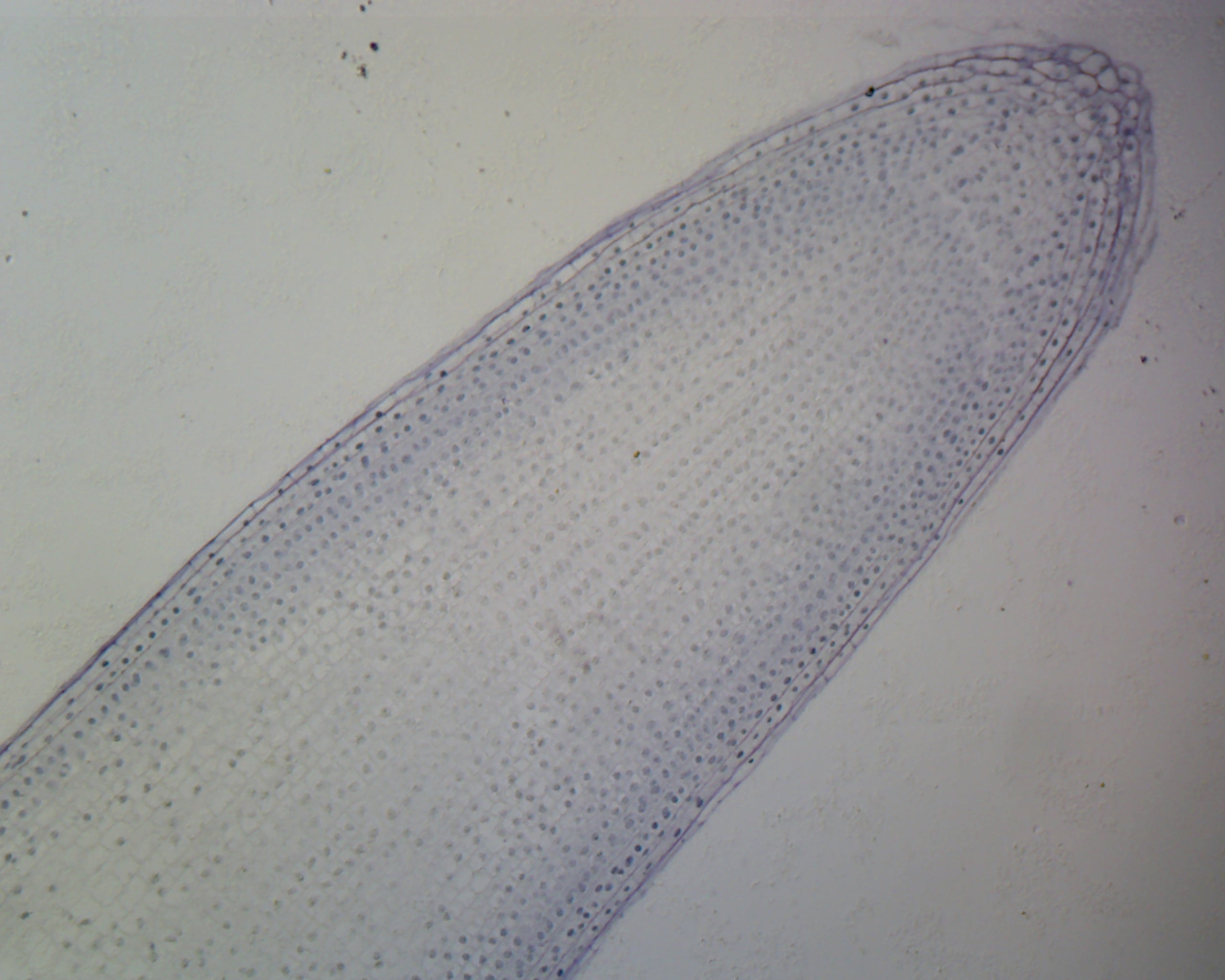 Onion Mitosis; Showing All Stages; Lateral Section by Go Science Crazy
