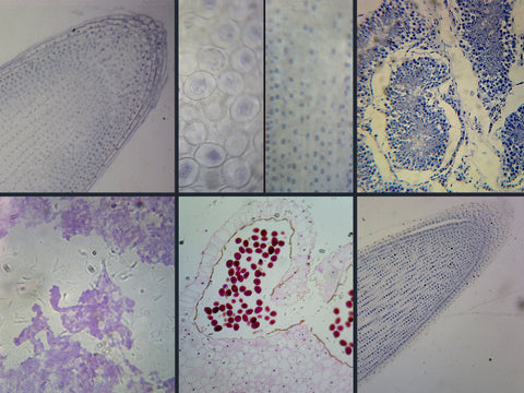 GSC International PS99340 General Biology Microscope Slide Set – 6 Slides