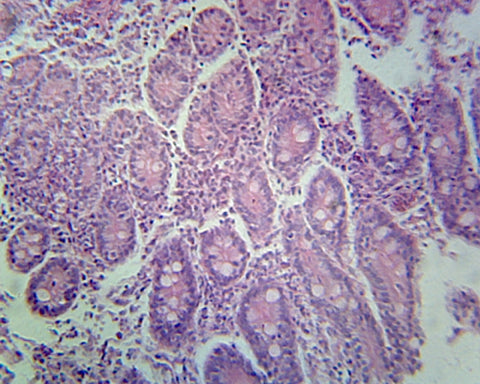 Frog Stomach; Section; H&E Stain by Go Science Crazy