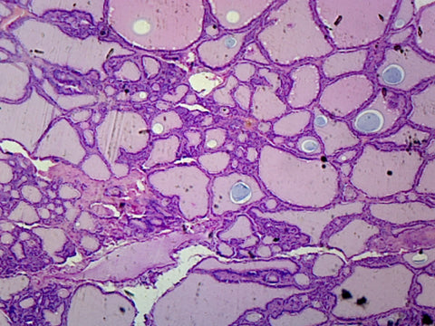 Goiter (Human Endocrine System); Section; H&E Stain by Go Science Crazy