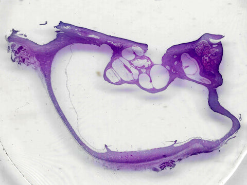 GSC International PS0264 Cochlea, Mammal; Showing Inner Ear and Organ of Corti; Longitudinal Section; H&E Stain