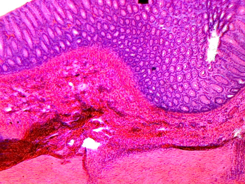 GSC International PS0214 Colon, Mammalian; Showing Typical Histology Structures; Cross Section