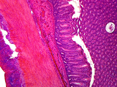 GSC International PS0195 Colon, Human; Showing Typical Histology Structures; Cross Section