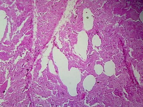 Lung, Human; Showing Alveoli; Section by Go Science Crazy