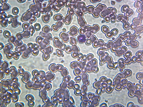 Iron-Deficient Anemia Blood (Human); Smear; GS Stain; Showing Peripheral Blood Film with Small, Pale Red Blood Cells by Go Science Crazy