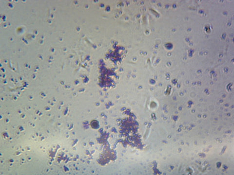 Haemophilus (Gram-Negative) and Streptoccus pneumoniae (Gram-Positive); Smear by Go Science Crazy