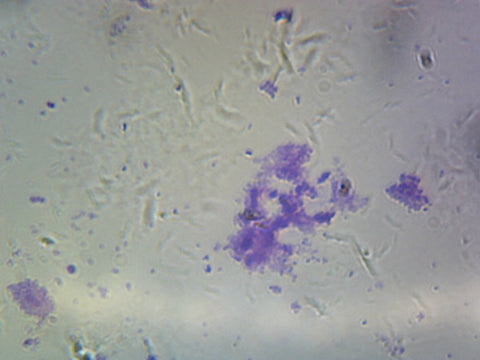 GSC International PS0326 Streptococcus Pneumoniae (Diplococcus); Smear; Gram-Positive
